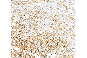 anti-CD44 (CD44) (AA 700-742) antibody