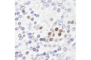 Immunohistochemistry (IHC) image for anti-Zinc Fingers and Homeoboxes 3 (ZHX3) (AA 150-200) antibody (ABIN7449040) (ZHX3 anticorps  (AA 150-200))