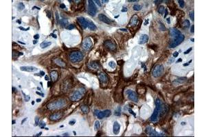 Image no. 2 for anti-Keratin 18 (KRT18) (AA 69-372) antibody (ABIN1491637)