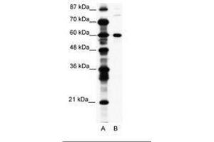 Image no. 1 for anti-CCR4-NOT Transcription Complex, Subunit 3 (CNOT3) (AA 141-190) antibody (ABIN203225) (CNOT3 anticorps  (AA 141-190))
