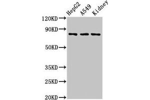Western Blot Positive WB detected in: HepG2 whole cell lysate, A549 whole cell lysate, Rat kidney tissue All lanes: UIMC1 antibody at 3 μg/mL Secondary Goat polyclonal to rabbit IgG at 1/50000 dilution Predicted band size: 80, 62, 71, 39, 18 kDa Observed band size: 80 kDa (UIMC1 anticorps  (AA 161-235))