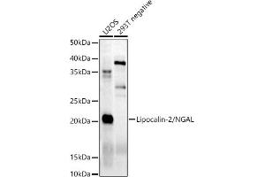 Western blot analysis of extracts of various cell lines, using Lipocalin-2/NGAL antibody (ABIN6128177, ABIN6143114, ABIN6143115 and ABIN6215076) at 1:500 dilution. (Lipocalin 2 anticorps)
