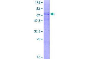 Image no. 1 for 1-Acylglycerol-3-Phosphate O-Acyltransferase 4 (AGPAT4) (AA 1-378) protein (GST tag) (ABIN1344582)