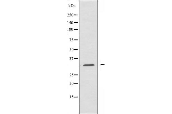 ABHD11 anticorps  (C-Term)