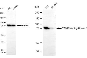 Western blotting analysis using TANK binding kinase 1 antibody (ABIN7800506).