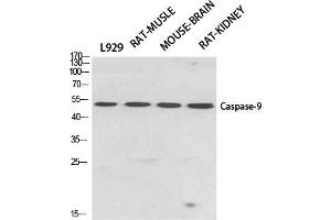 Western Blotting (WB) image for anti-Caspase 9, Apoptosis-Related Cysteine Peptidase (CASP9) (Thr125) antibody (ABIN5960804) (Caspase 9 anticorps  (Thr125))