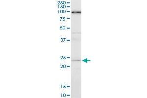ATG5 monoclonal antibody (M05), clone 1E7. (ATG5 anticorps  (AA 176-275))