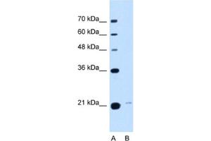Western Blotting (WB) image for anti-Transmembrane Emp24 Protein Transport Domain Containing 3 (TMED3) antibody (ABIN2463022) (TMED3 anticorps)