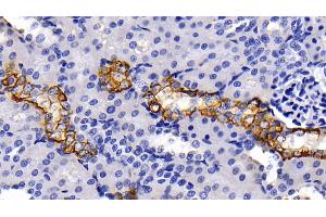 Detection of CK5 in Rat Kidney Tissue using Polyclonal Antibody to Cytokeratin 5 (CK5)