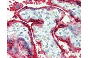 anti-Growth Hormone 1 (GH1) antibody