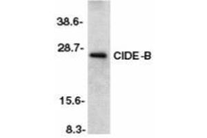 Western blot analysis of CIDE-B in mouse liver tissue lysate with AP30231PU-N CIDE-B antibody at 1/500 dilution. (CIDEB anticorps  (C-Term))