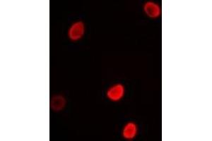 Immunofluorescent analysis of L3MBTL3 staining in MCF7 cells. (L3MBTL3 anticorps)