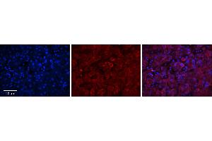 Rabbit Anti-GGCX Antibody      Formalin Fixed Paraffin Embedded Tissue: Human Adult Liver   Observed Staining: Cytoplasm in hepatocytes, strong signal, wide tissue distribution  Primary Antibody Concentration: 1:100  Secondary Antibody: Donkey anti-Rabbit-Cy3  Secondary Antibody Concentration: 1:200  Magnification: 20X  Exposure Time: 0.