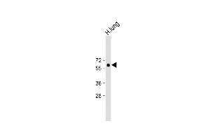 Anti-SD6 Antibody (Center) at 1:500 dilution + H. (SMAD6 anticorps  (AA 358-386))