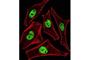 Fluorescent ige of Hela cells stained with SRCD3 Antibody (N-term) (ABIN6242643 and ABIN6577395). (SMARCD3 anticorps  (N-Term))