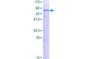 Image no. 1 for RELT Tumor Necrosis Factor Receptor (RELT) (AA 1-430) protein (GST tag) (ABIN1317789)