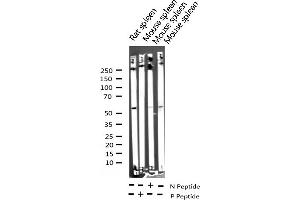 Western blot analysis of Phospho-Lck (Tyr393) expression in various lysates