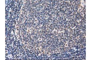 Image no. 8 for anti-Striatin Interacting Protein 1 (STRIP1) antibody (ABIN1498205) (STRIP1 anticorps)