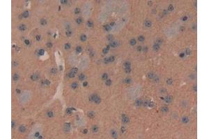 Detection of ATP2B2 in Mouse Cerebrum Tissue using Polyclonal Antibody to ATPase, Ca++ Transporting, Plasma Membrane 2 (ATP2B2)