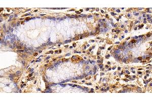 Detection of EGFR in Human Stomach Tissue using Monoclonal Antibody to Epidermal Growth Factor Receptor (EGFR) (EGFR anticorps  (AA 888-1210))