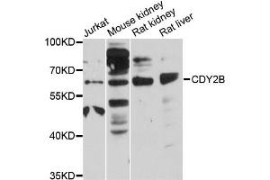 Western blot analysis of extracts of various cell lines, using CDY2B antibody (ABIN6292882) at 1:3000 dilution. (CDY2A anticorps)