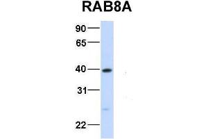 Host:  Rabbit  Target Name:  RAB8A  Sample Type:  Human Fetal Liver  Antibody Dilution:  1. (RAB8A anticorps  (Middle Region))