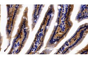 Detection of FABP1 in Mouse Colon Tissue using Polyclonal Antibody to Fatty Acid Binding Protein 1 (FABP1)