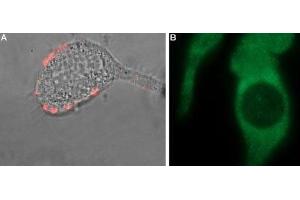Expression of TRPM8 in LNCaP prostate carcinoma cell line - Cell surface detection of TRPM8 in LNCaP cells with Anti-TRPM8 (extracellular) Antibody (ABIN7043837, ABIN7044016 and ABIN7044017).