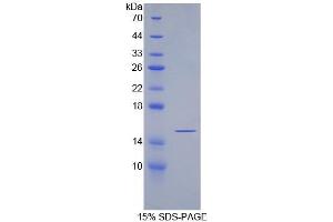 SDS-PAGE analysis of Rat SFRP5 Protein. (SFRP5 Protéine)