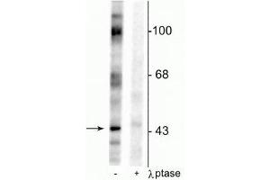 Western blot of rat testes lysate showing specific immunolabeling of the ~46 kDa EphrinB phosphorylated at Tyr317 in the first lane (-). (EPH Receptor B2 anticorps  (pTyr317))