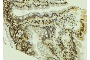 ABIN6269061 at 1/100 staining Mouse colon tissue by IHC-P. (JAK2 anticorps  (N-Term))