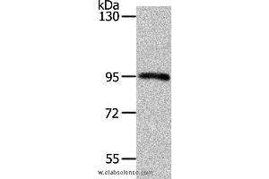 Western blot analysis of Mouse kidney tissue, using MYSM1 Polyclonal Antibody at dilution of 1:1100 (MYSM1 anticorps)