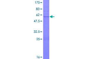 Image no. 1 for Dolichyl-Phosphate Mannosyltransferase Polypeptide 1, Catalytic Subunit (DPM1) (AA 1-260) protein (GST tag) (ABIN1351941)