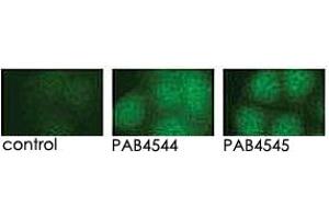 Indirect immunofluorescence analysis of GFP-PRKD3 fusion protein expression in Panc-1 cells by using PRKD3 polyclonal antibody  and PRKD3 polyclonal antibody  . (PRKD3 anticorps  (Internal Region))