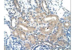 Image no. 1 for anti-Alcohol Dehydrogenase 1B (Class I), beta Polypeptide (ADH1B) (AA 301-350) antibody (ABIN203498)