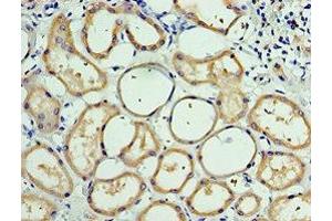 Immunohistochemistry of paraffin-embedded human kidney tissue using ABIN7146236 at dilution of 1:100 (CDH6 anticorps  (AA 1-250))