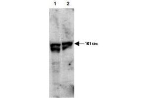 Western blot using ECT2 (phospho T790) polyclonal antibody  showsdetection of endogenous phospho-ECT2 (arrowhead) present in cell lysates from interphase (Lane 1) and mitotic (Lane 2) HeLa cells. (ECT2 anticorps  (pThr790))