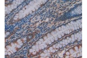 Detection of PLXNB1 in Human Rectum Tissue using Polyclonal Antibody to Plexin B1 (PLXNB1) (PLXNB1 anticorps  (AA 200-727))