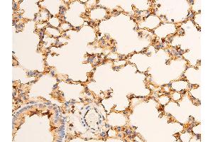 ABIN6267232 at 1/100 staining mouse lung tissue sections by IHC-P.