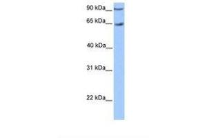 Image no. 1 for anti-Zinc Finger Protein 449 (ZNF449) (AA 431-480) antibody (ABIN6739107) (ZNF449 anticorps  (AA 431-480))
