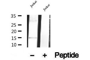 Western blot analysis of extracts of Jurkat cells, using SH2D1B antibody. (SH2D1B anticorps  (Internal Region))