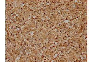 IHC image of ABIN7163202 diluted at 1:200 and staining in paraffin-embedded human adrenal gland tissue performed on a Leica BondTM system.