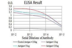 Black line: Control Antigen (100 ng),Purple line: Antigen (10 ng), Blue line: Antigen (50 ng), Red line:Antigen (100 ng)