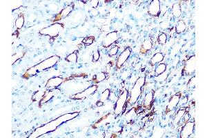 Immunohistochemistry of paraffin-embedded mouse kidney using Cytokeratin 7 (KRT7) (KRT7) Rabbit mAb  at dilution of 1:100 (40x lens). (Cytokeratin 7 anticorps)