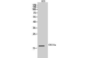Western Blotting (WB) image for anti-Glycophorin A (GYPA) (Internal Region) antibody (ABIN3181476) (CD235a/GYPA anticorps  (Internal Region))