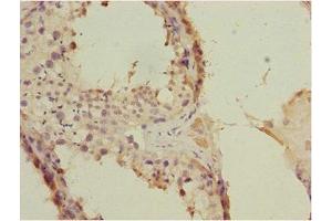 Immunohistochemistry of paraffin-embedded human testis tissue using ABIN7152675 at dilution of 1:100 (FLVCR2 anticorps  (AA 1-100))