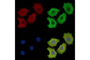 ABIN7095406 and ABIN7099463 staining HepG2 cells by IF/ICC.