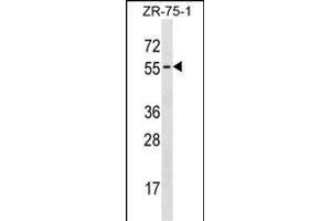 TCN1 Antibody (C-term) (ABIN1537288 and ABIN2838197) western blot analysis in ZR-75-1 cell line lysates (35 μg/lane). (TCN1 anticorps  (C-Term))