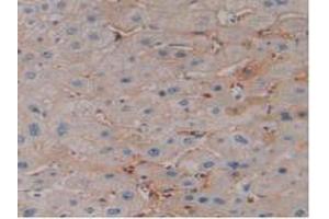 DAB staining on IHC-P; Samples: Human Liver Tissue (EPO anticorps  (AA 28-193))