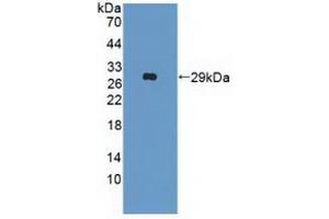 Figure. (IFNAR2 anticorps  (AA 27-243))